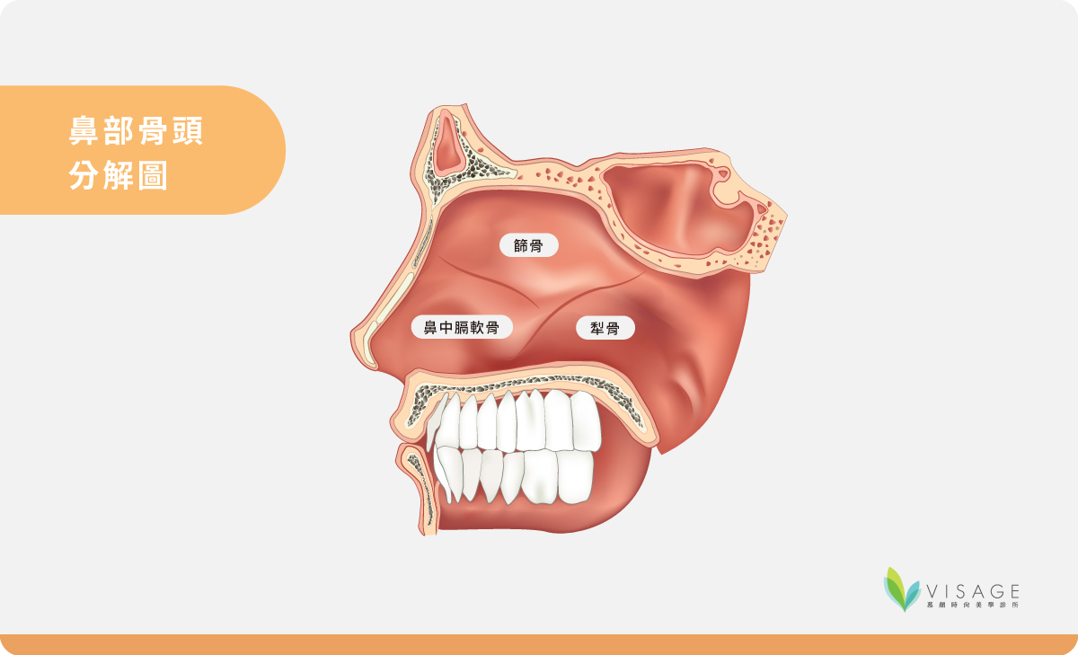 |醫師專欄|你的鼻中膈彎曲需要治療嗎? - 慕顏時尚美學診所
