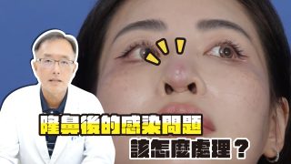 封面yt