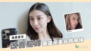 封面yt