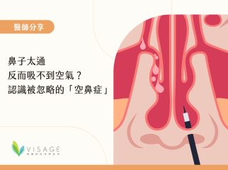 空鼻症是什麼-01