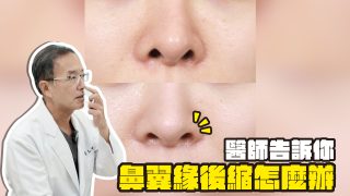 醫師告訴你 鼻翼緣後縮怎麼辦yt